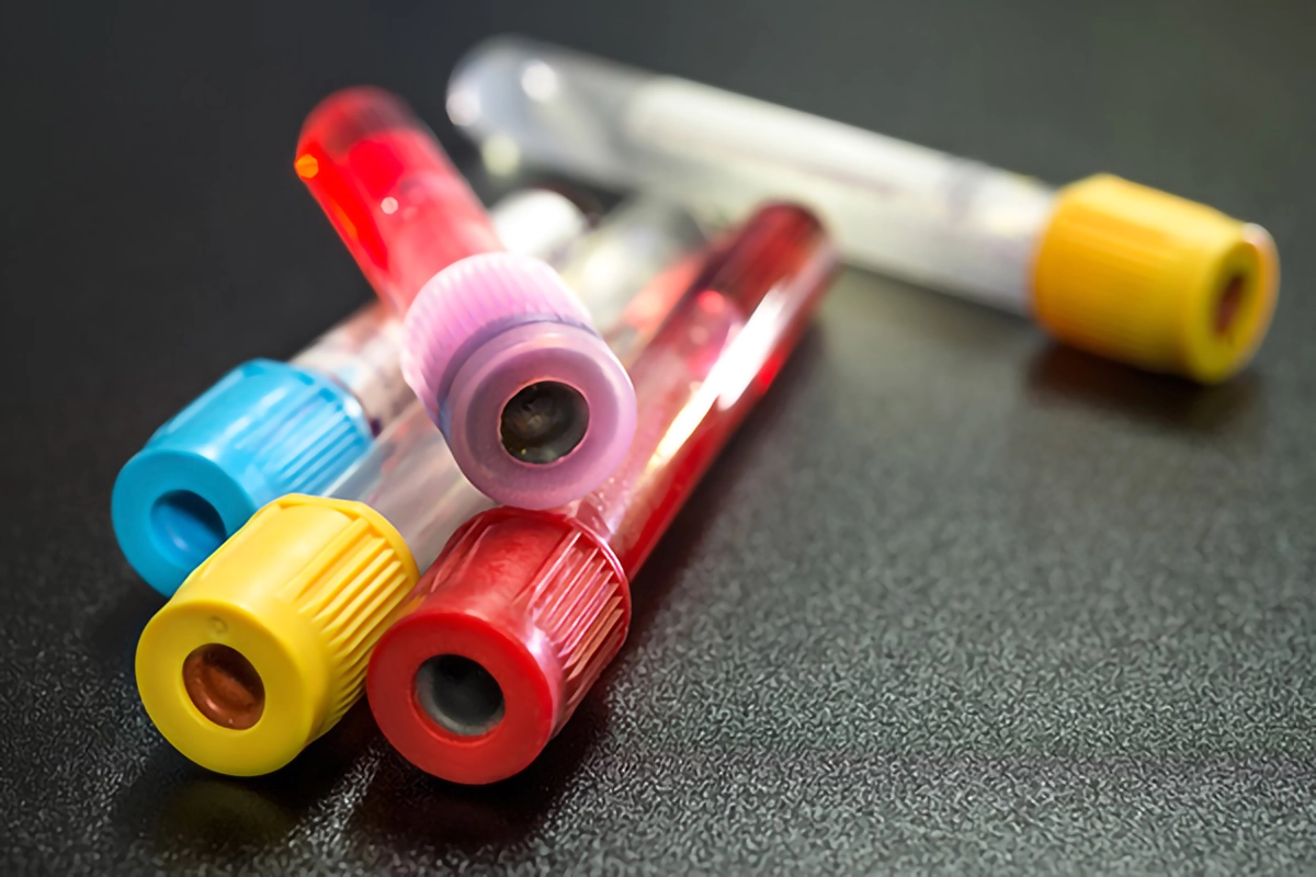 Image of blood test tubes
